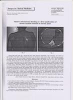 Massive subcutaneous bleeding as a first manifestation of chronic myeloid leukemia in chronic phase